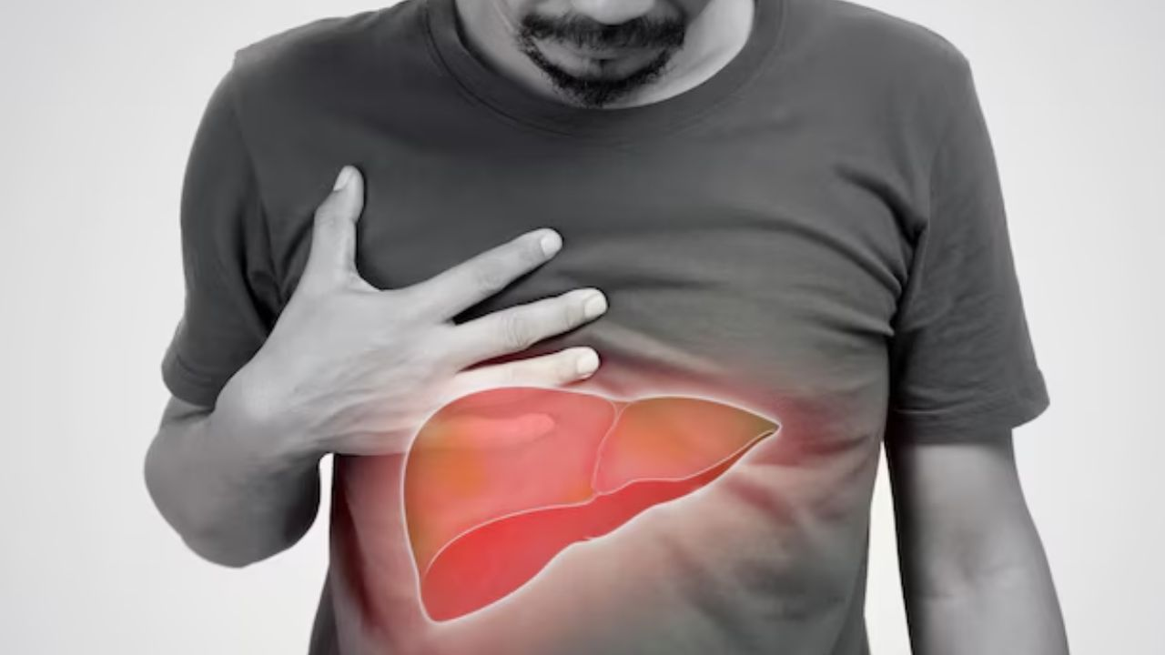 Fatty Liver