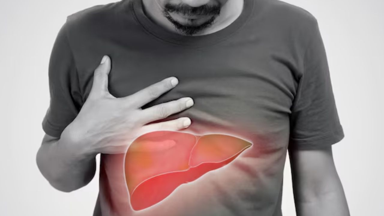 fatty liver