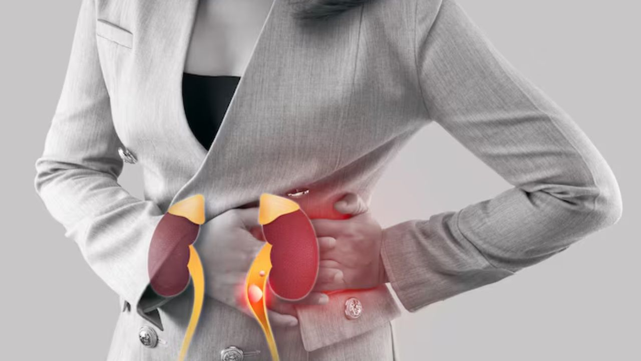 kidney stone