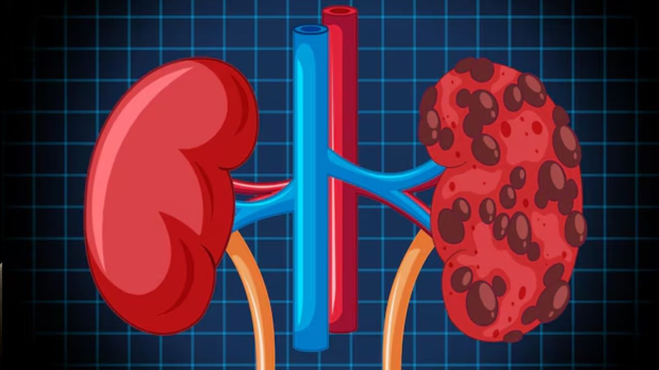 kidney