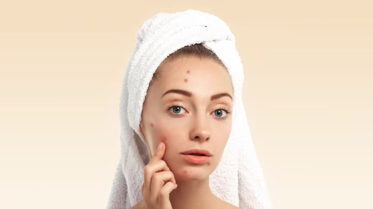 skin care tips