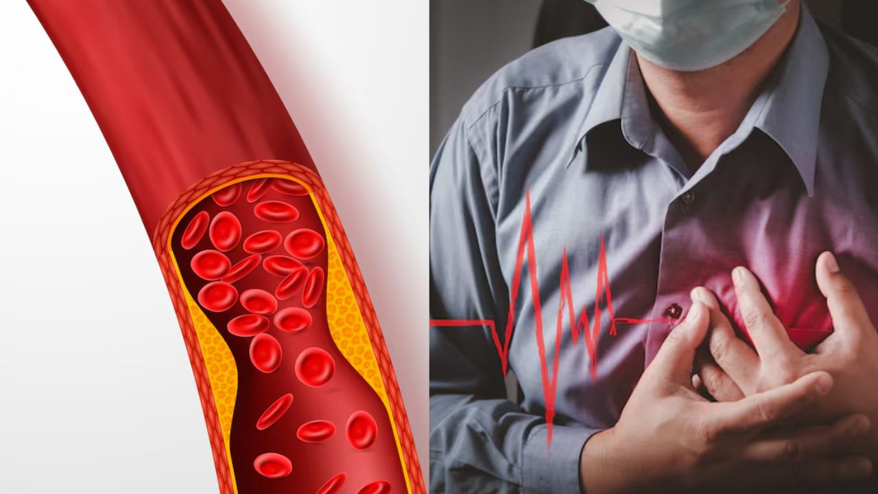 high Cholesterol increase heart attack