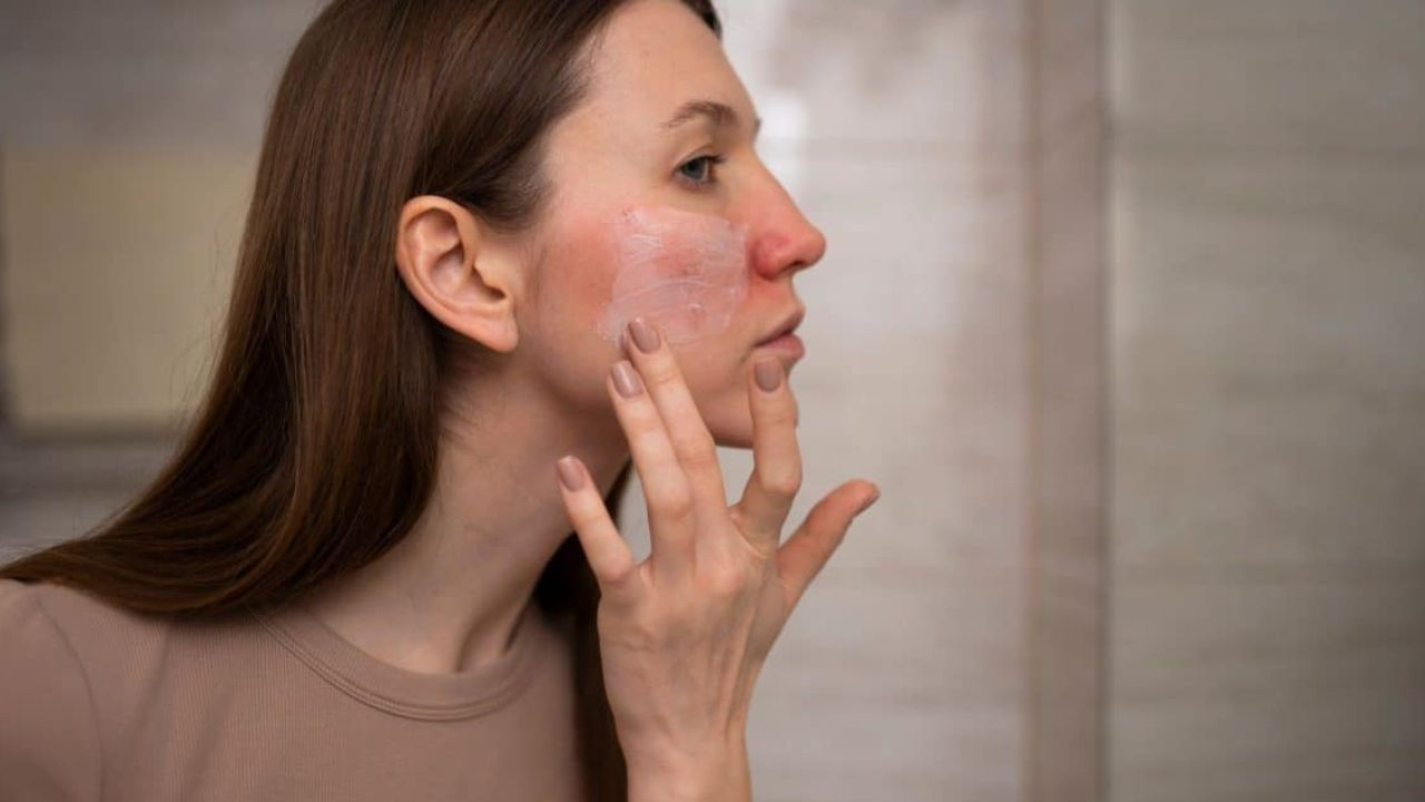 skin problem rainy season