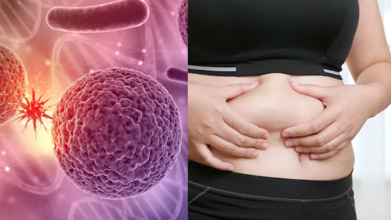 obestity cause cancer