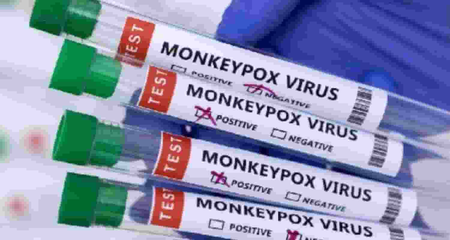 Mpox could turn into next global pandemic 