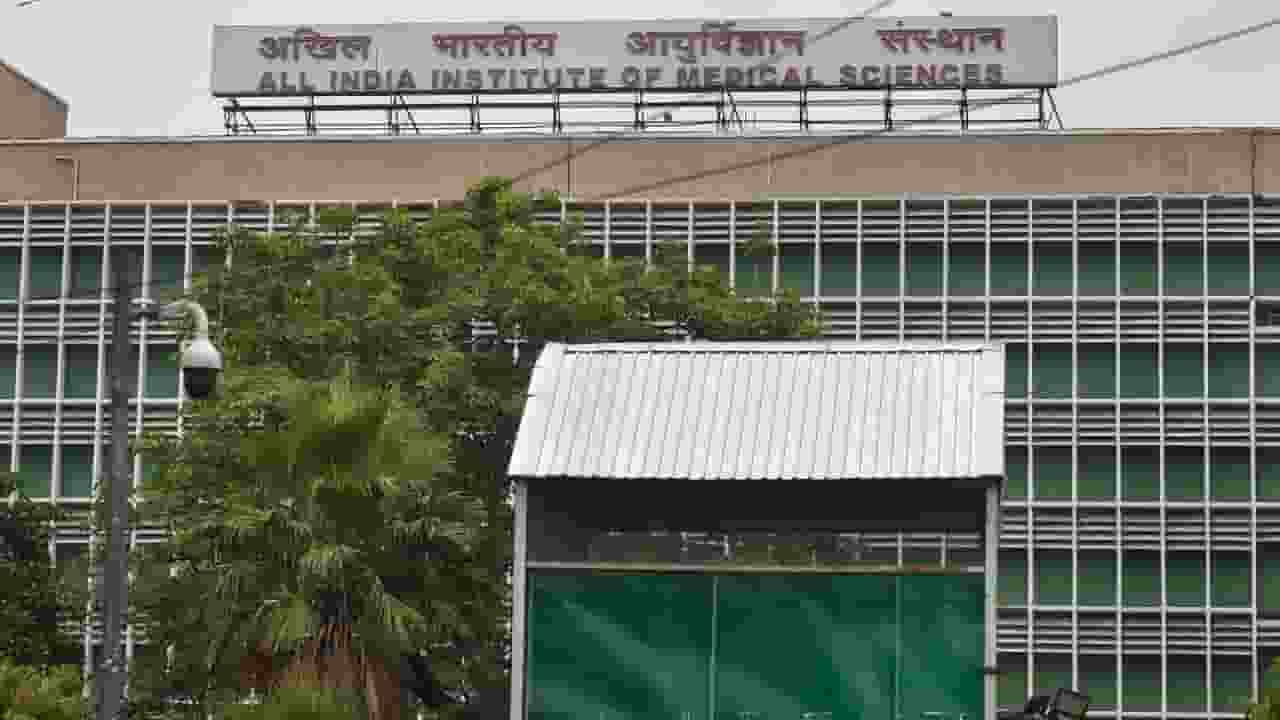Parasitic Twin AIIMS 