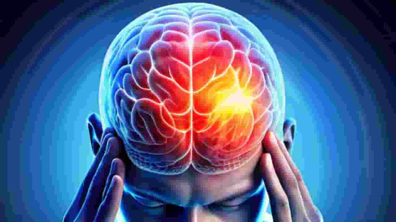 brain stroke