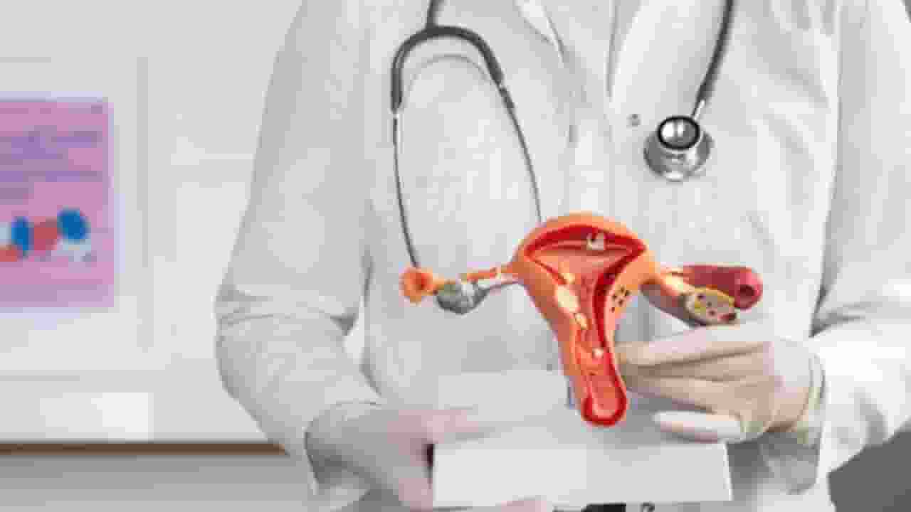 cervical cancer