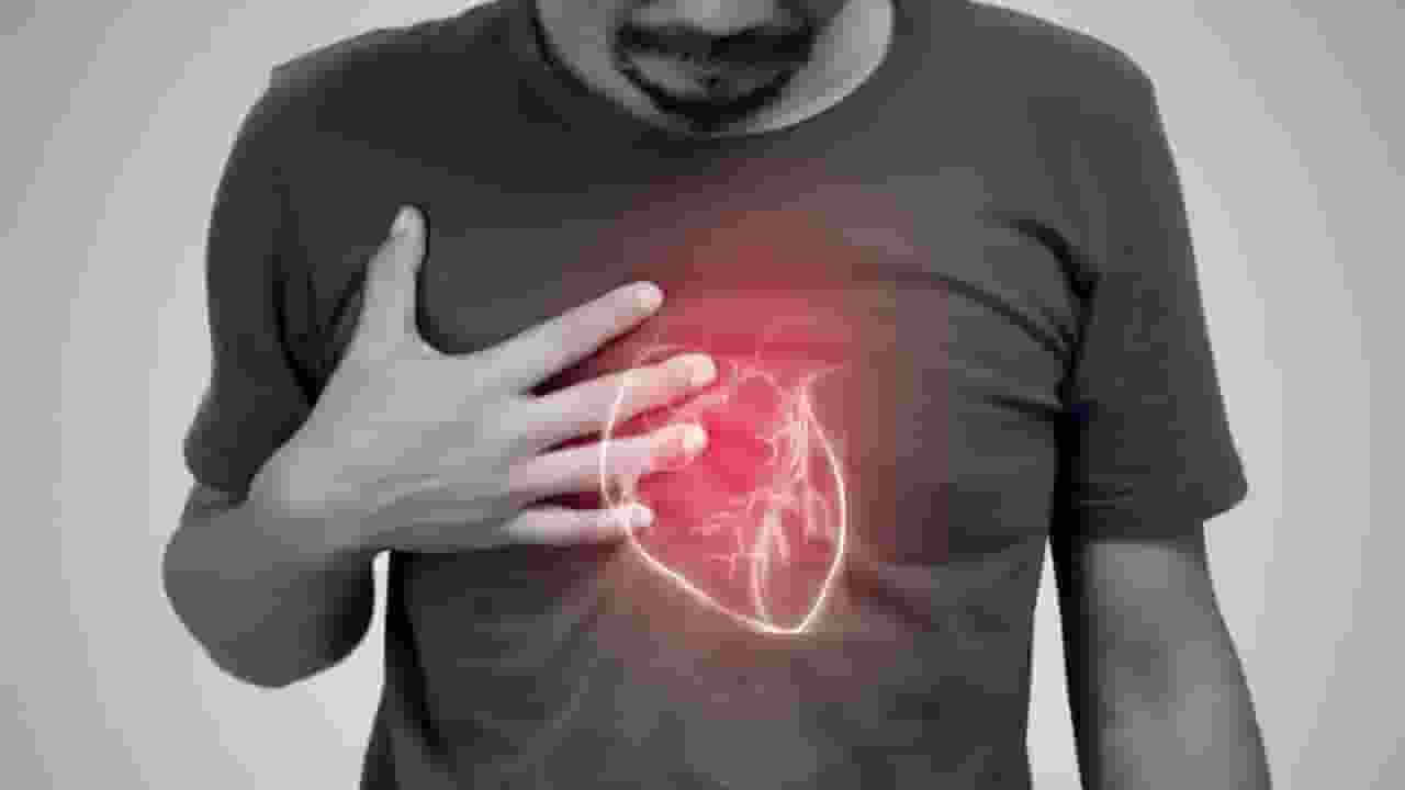 heart attack