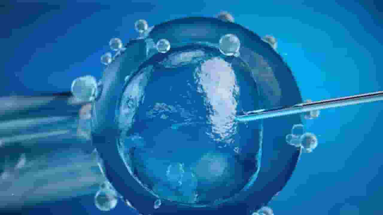 ivf