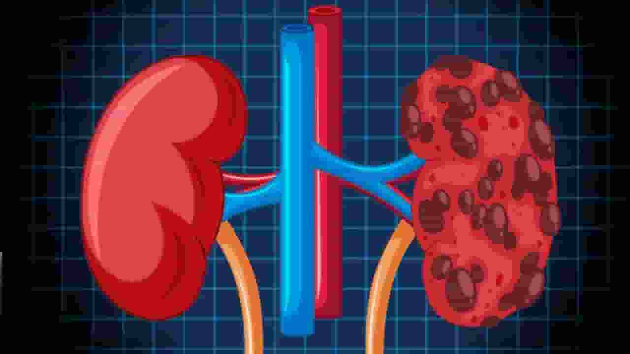 kidney