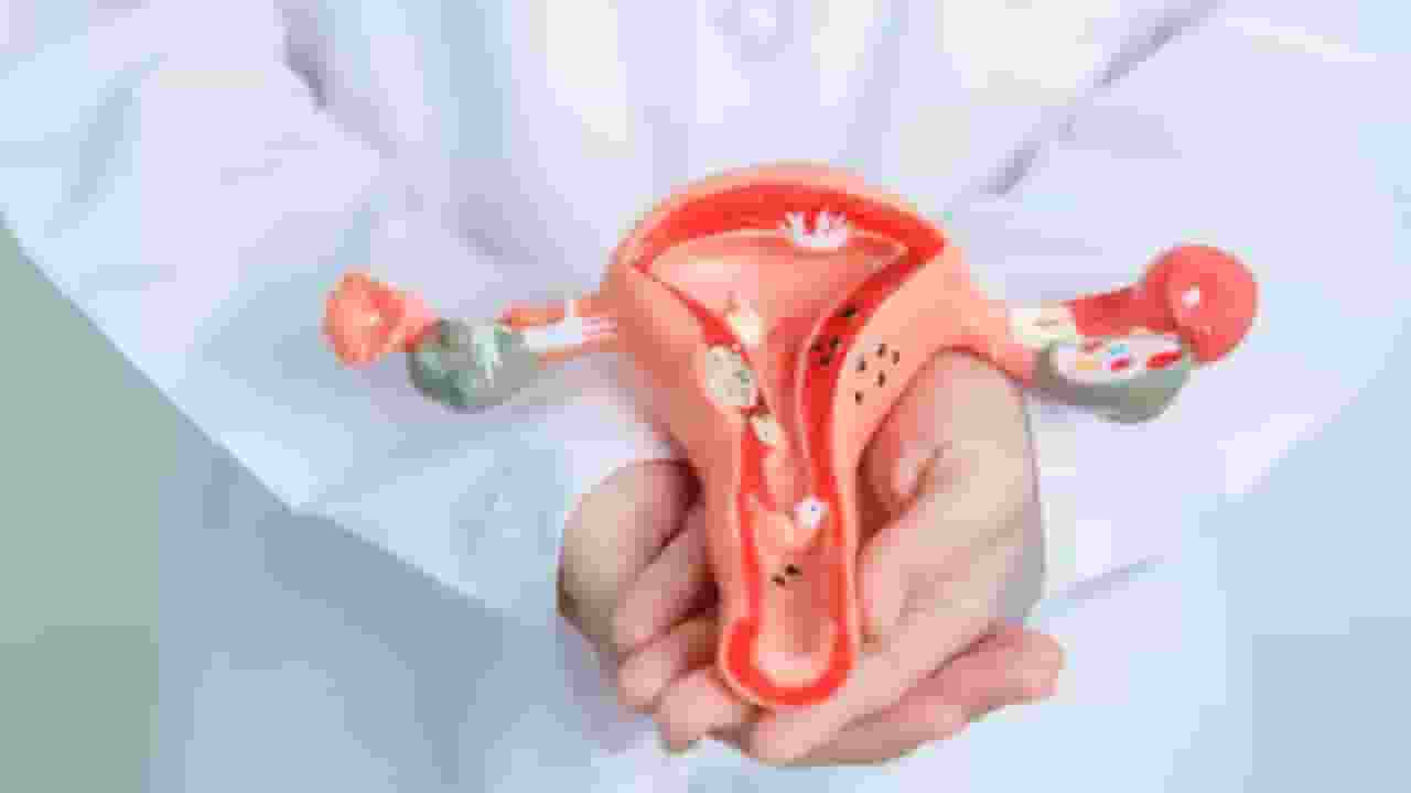 cervical cancer