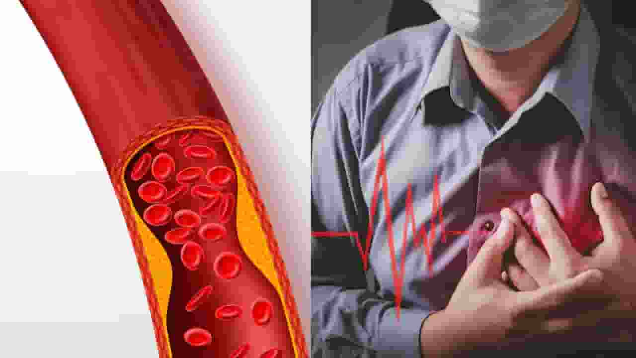 high Cholesterol increase heart attack