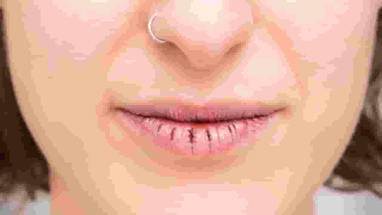 dry lips