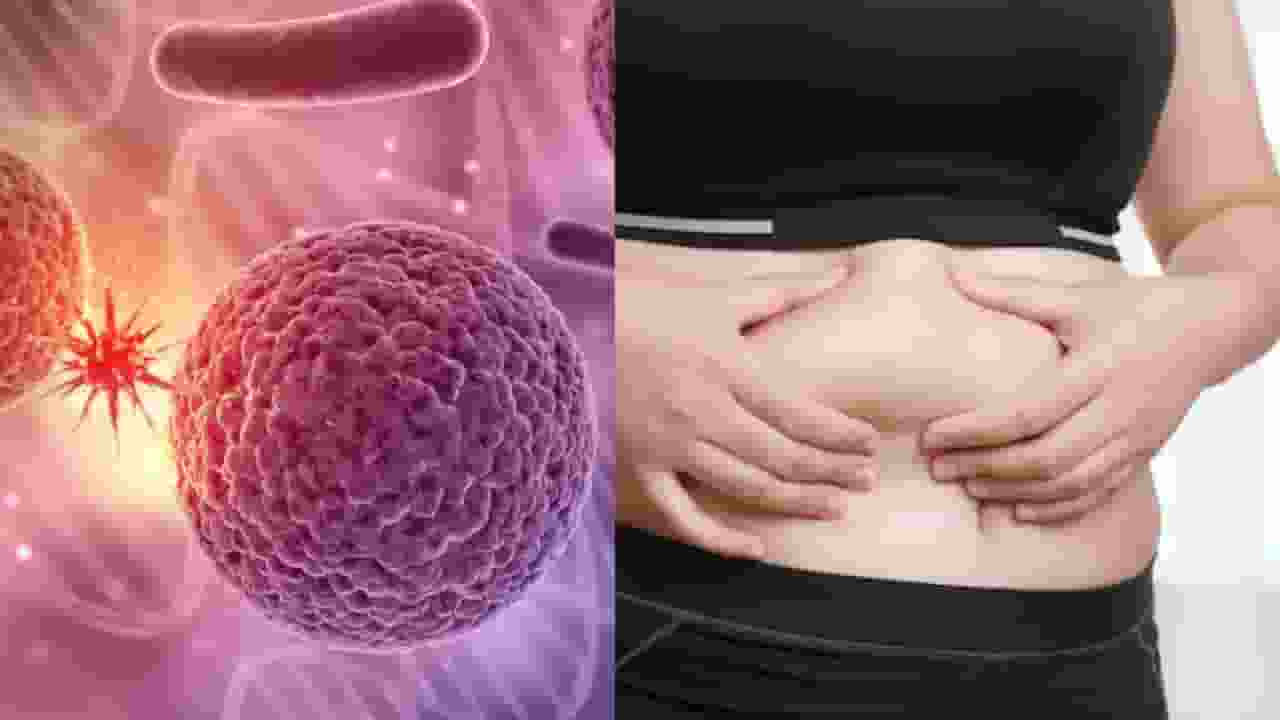 मोटापे की वजह से बढ़ रहा है कैंसर का खतरा, स्टडी में हुआ खुलासा obestity cause cancer