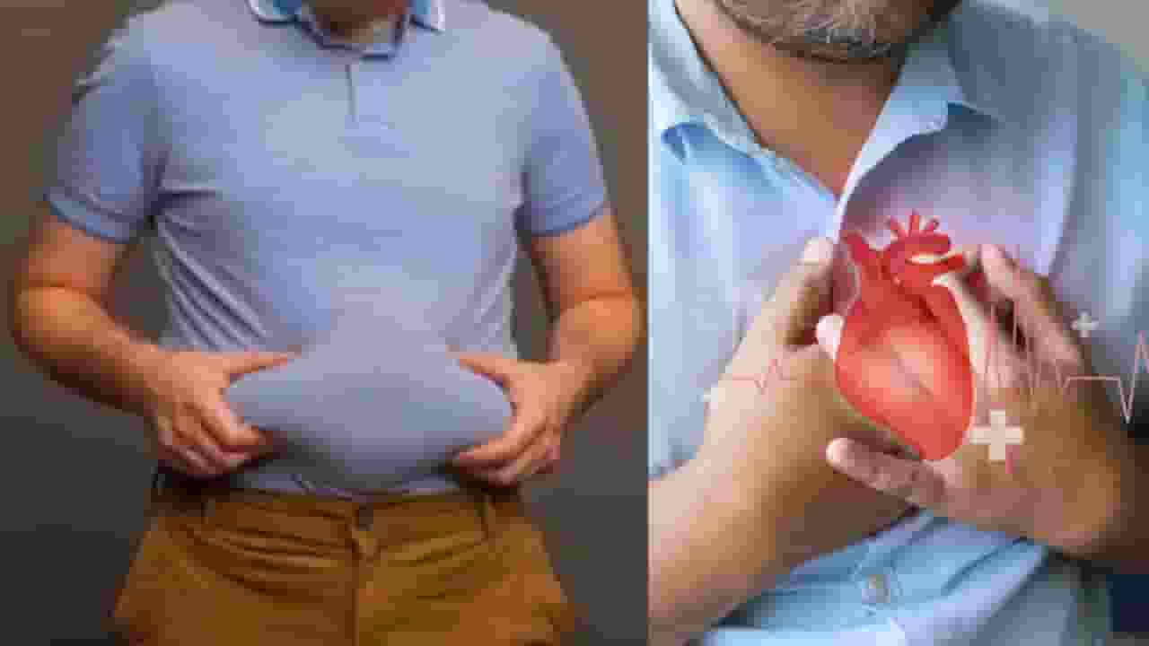 obesity cause heart attack